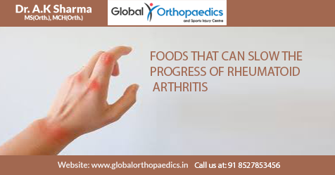 FOODS THAT CAN SLOW THE PROGRESS OF RHEUMATOID ARTHRITIS