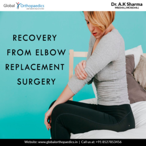 elbow replacement