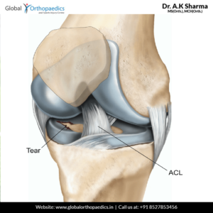 arthroscopic-surgery-of knee