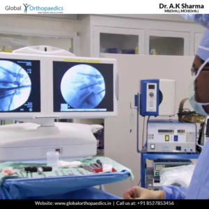 arthroscopic surgery