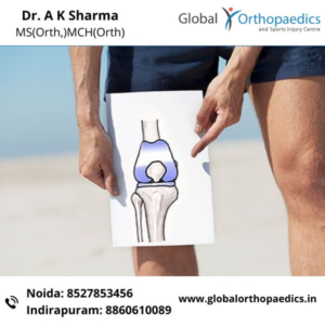 Knee replacement surgeon in Noida