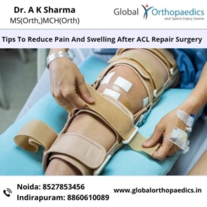 Best ACL Surgeon in Delhi NCR | Best Arthroscopy Surgeon in Delhi NCR