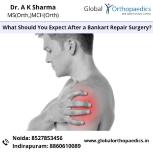 Bankart Repair Doctors in Noida | Bankart Repair Treatment in Noida