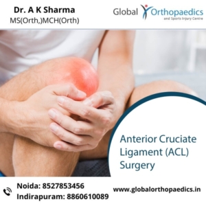 best ACL surgeon in Delhi NCR, best arthroscopy surgeon in Delhi NCR, best ACL surgeon in Noida