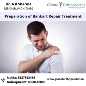 bankart repair treatment in Noida, bankart repair doctors in Noida, bankart repair in Noida