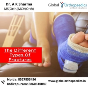 best orthopaedic doctor in Noida