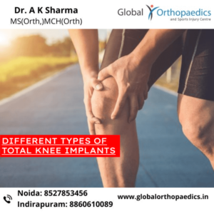 knee replacement surgeon in Noida