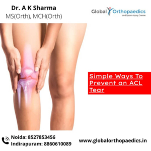 best ACL surgeon in Noida