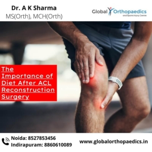 ACL surgery centre in Delhi NCR