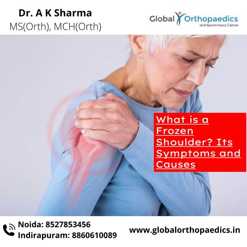 What is a Frozen Shoulder? Its Symptoms and Causes | Best Orthopedic ...