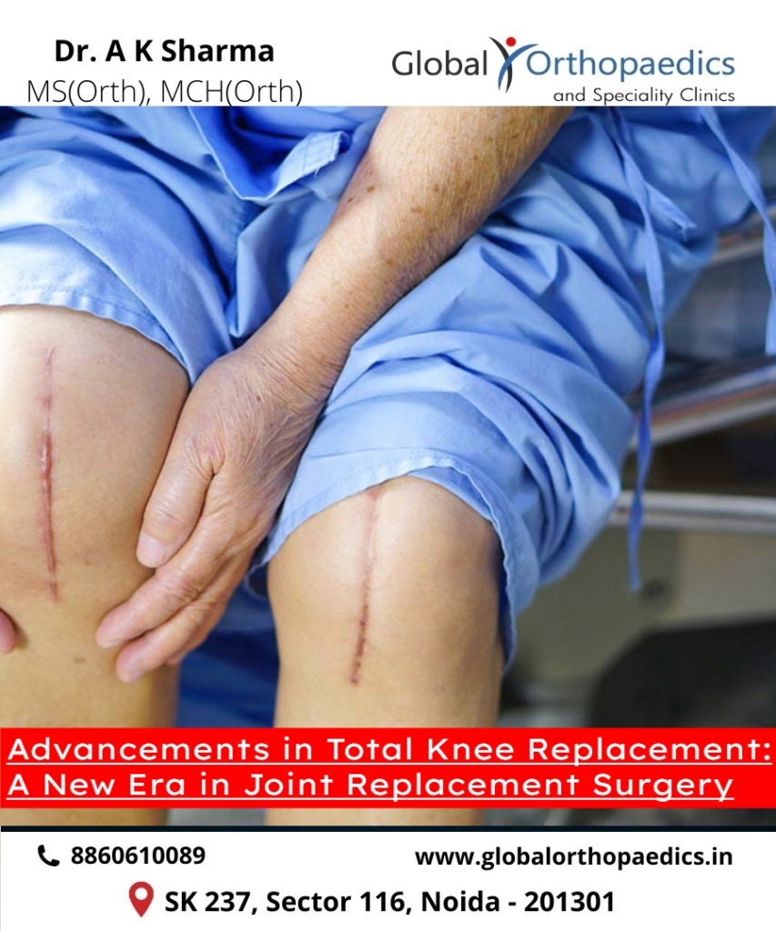 knee replacement surgeon in Noida